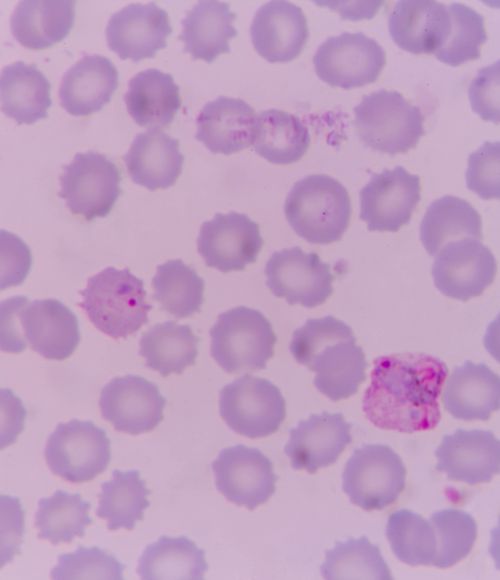 Malaria testing in Guyana